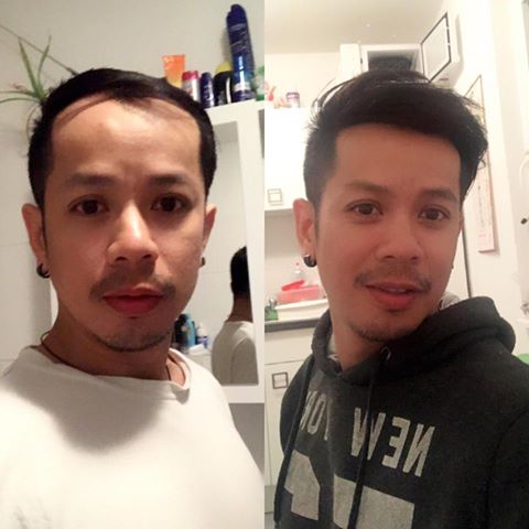 รวมภาพรีวิวลูกค้าวิกเต็มหัวบางส่วน