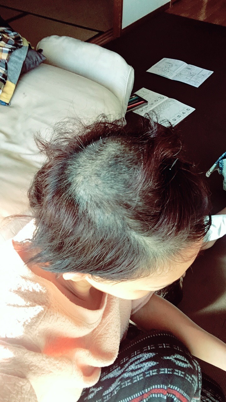 รวมภาพรีวิวลูกค้าวิกเต็มหัวบางส่วน