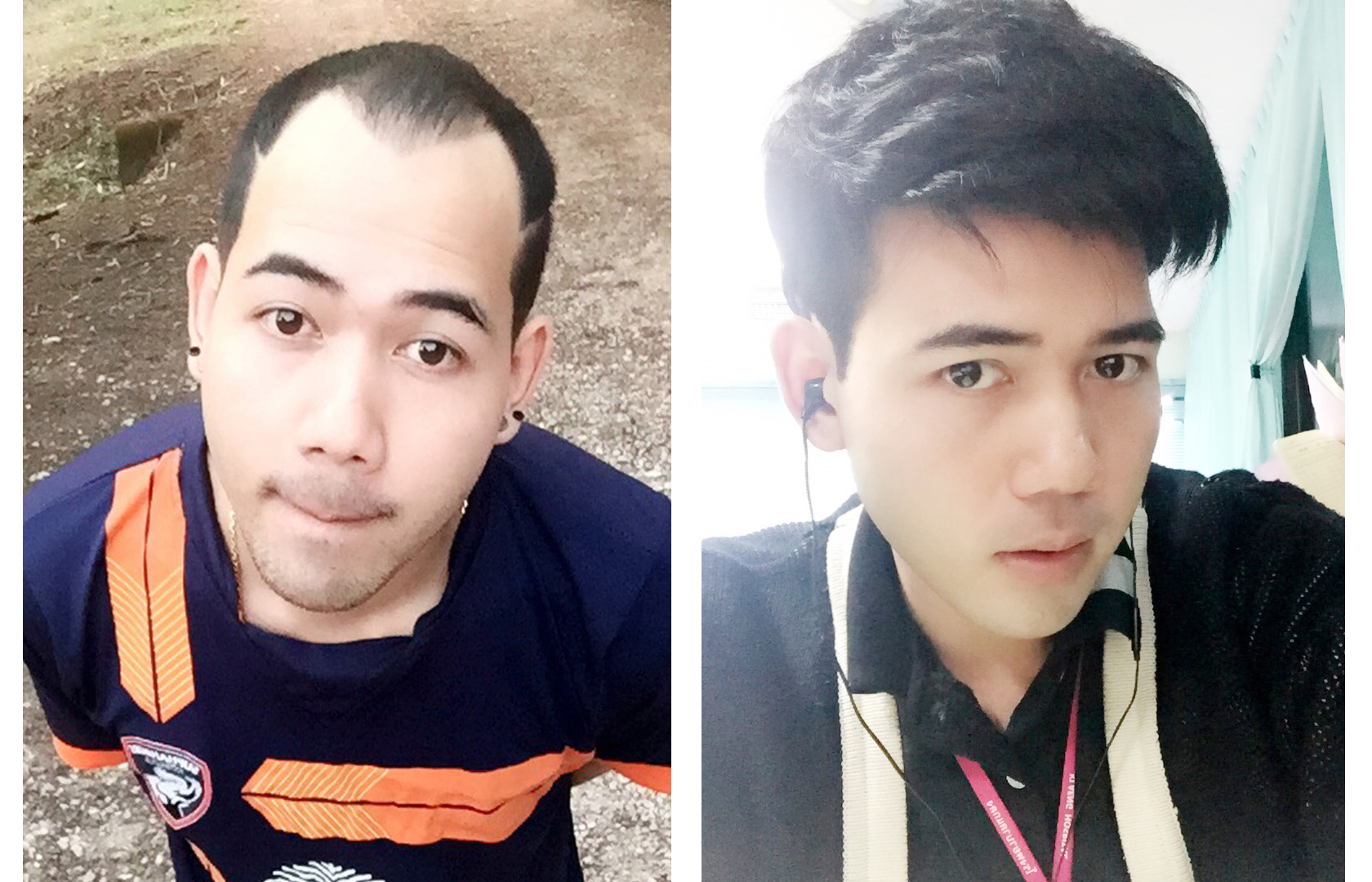 รวมภาพรีวิวลูกค้าวิกเต็มหัวบางส่วน
