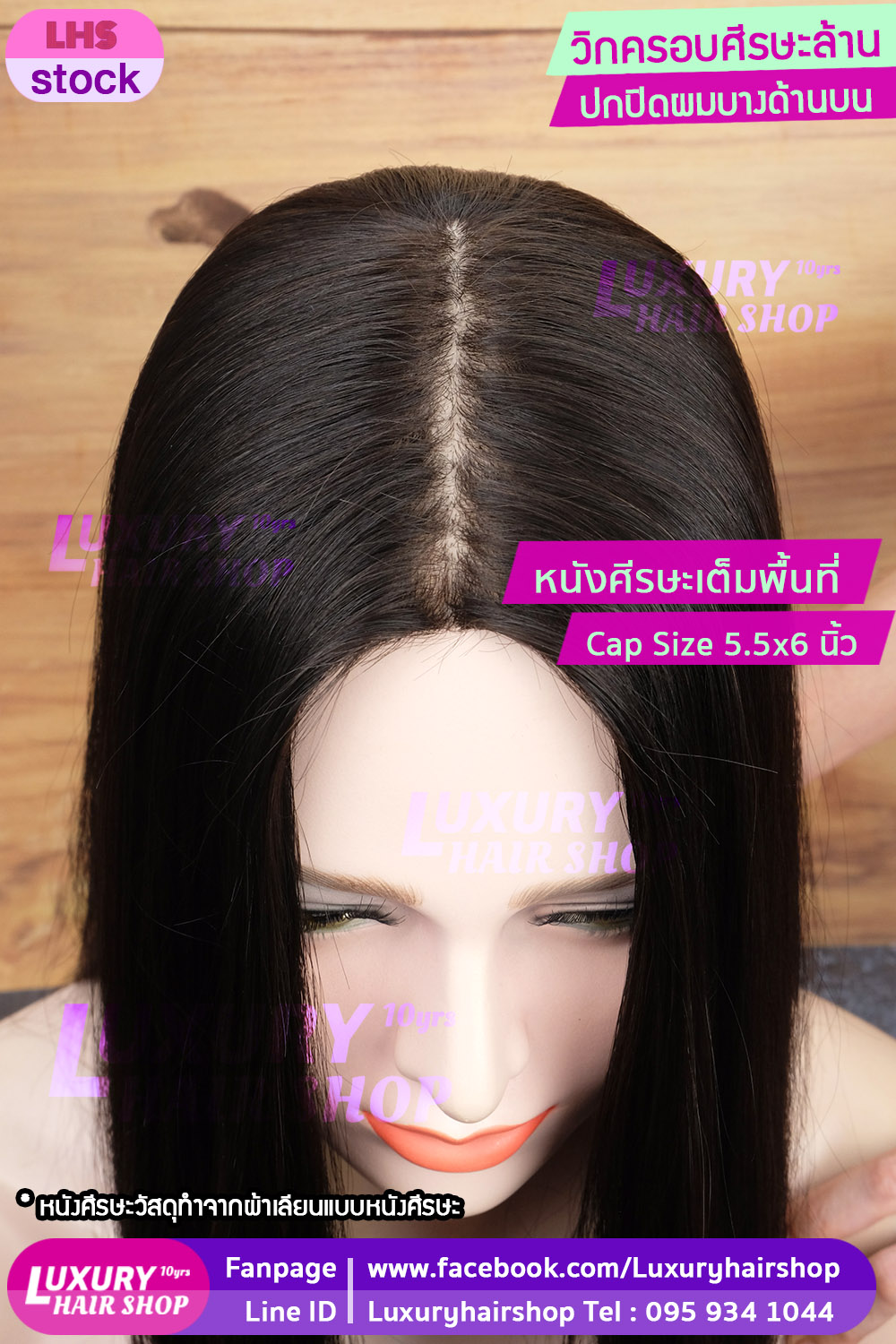 เสริมผมบาง ศีรษะล้านด้านบน เสริมผมบาง ศีรษะล้านด้านบน