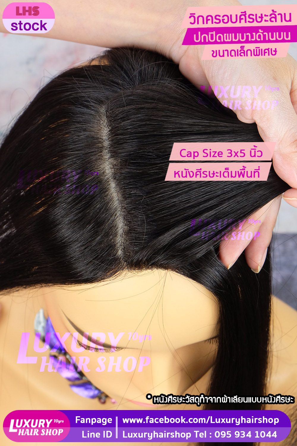 เสริมผมบาง ศีรษะล้านด้านบน เสริมผมบาง ศีรษะล้านด้านบน